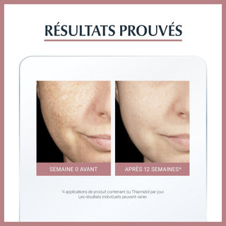 Eucerin Anti-Pigment Soin de Jour SPF 30, 50ml