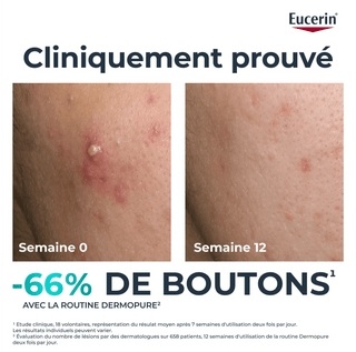Eucerin DermoPure Sérum Triple Action Anti-Marques