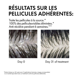 Vichy Dercos Shampoing Traitant Anti-Pelliculaire pour Cheveux Secs 200ml